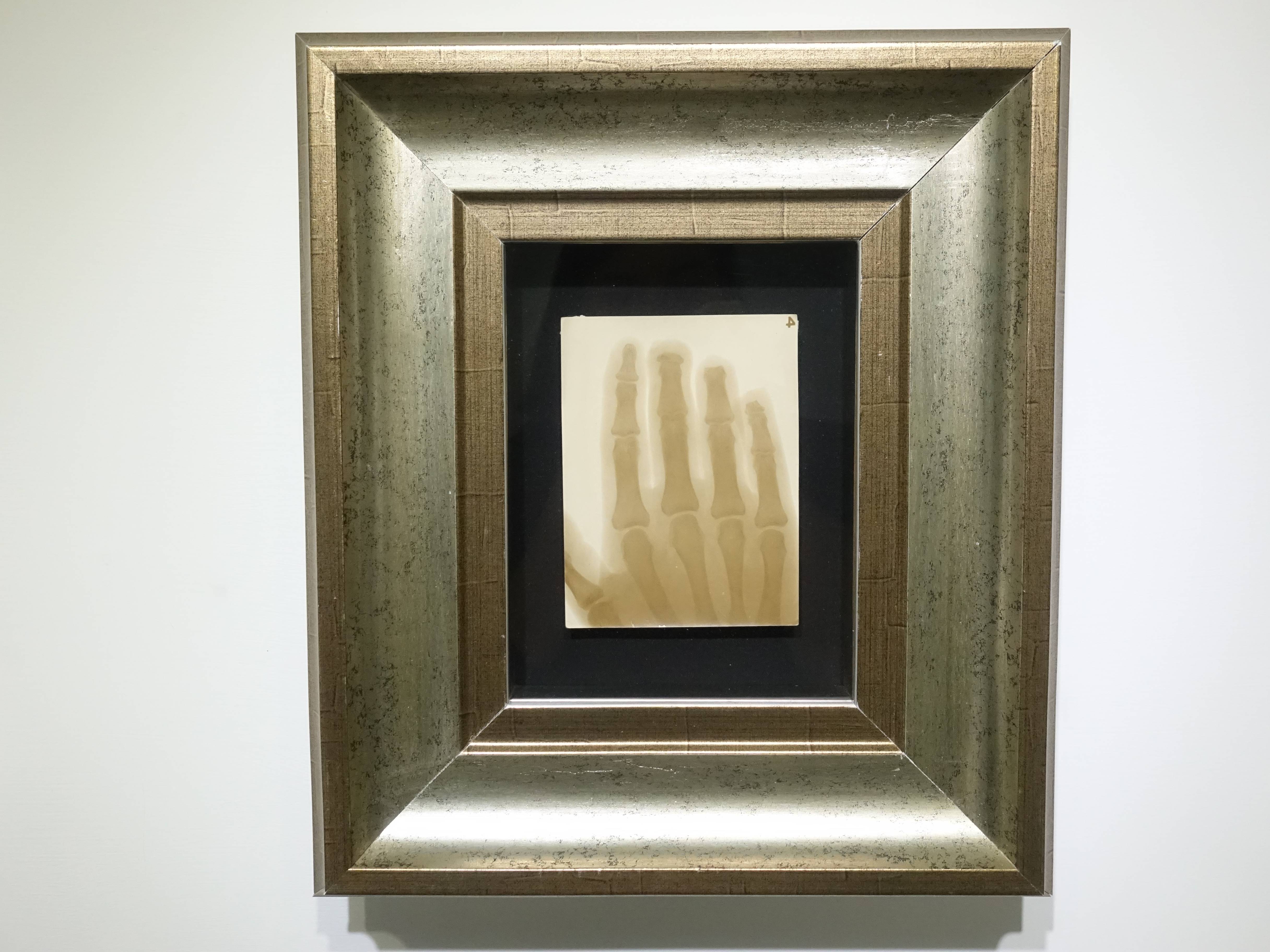 彭瑞麟，《彭瑞麟在東京寫專時以X光拍攝鐵工廠工人的手》，38x28 cm，X光攝影，1930。