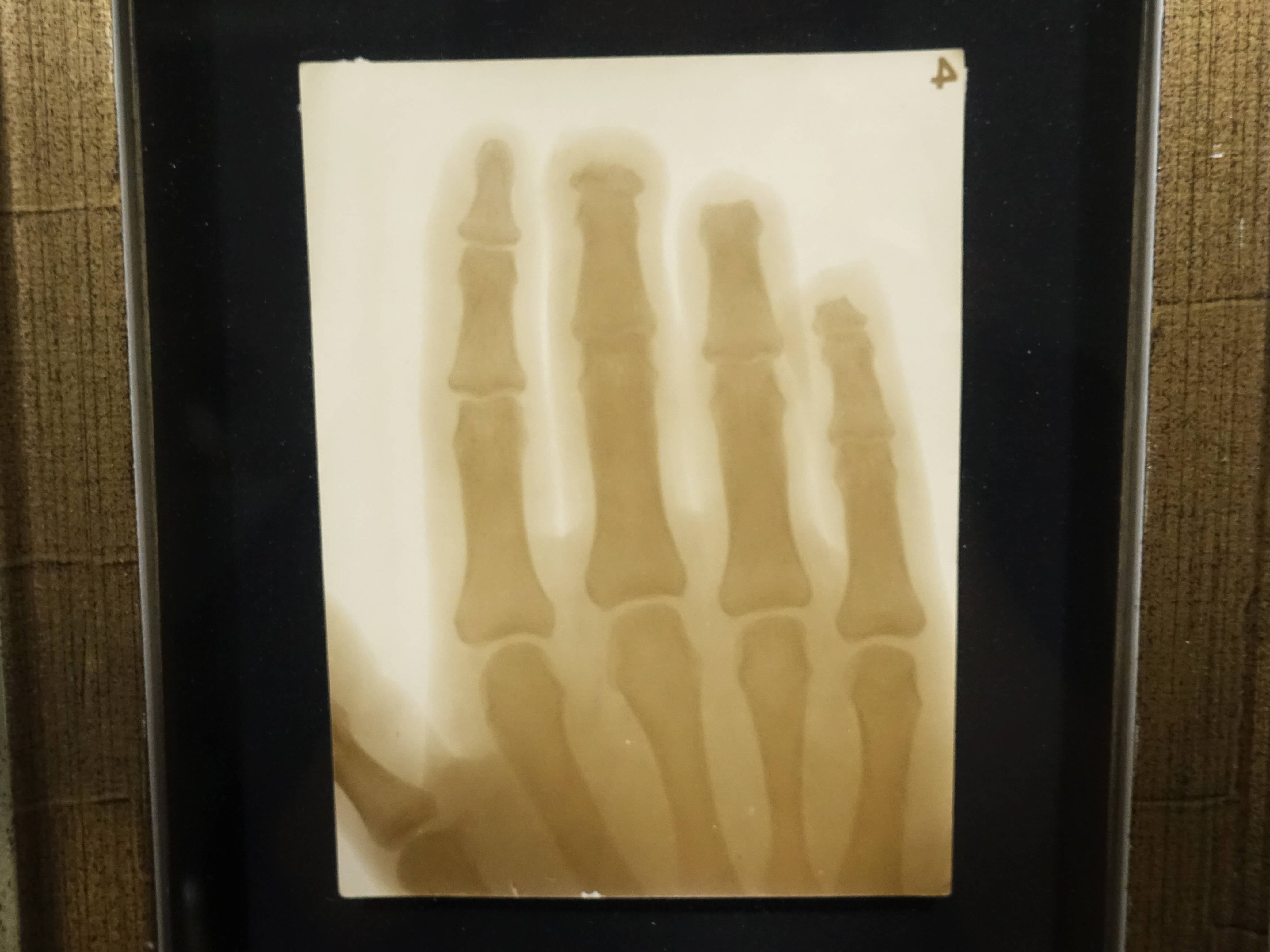 彭瑞麟，《彭瑞麟在東京寫專時以X光拍攝鐵工廠工人的手》細節，38x28 cm，X光攝影，1930。