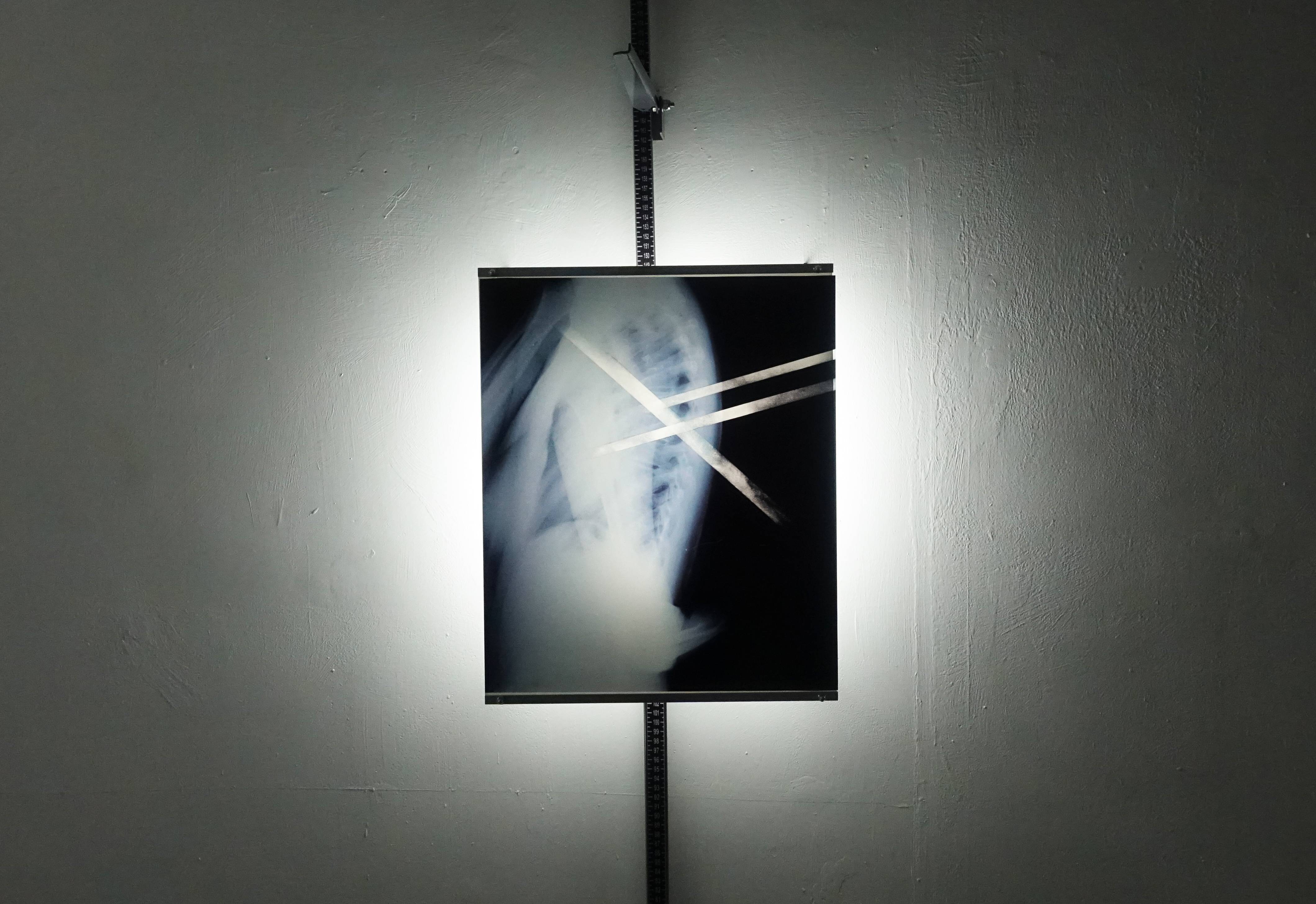 陳泳丞，《【】II》，200 x 35 x 23 cm，X光片、身高尺2019。